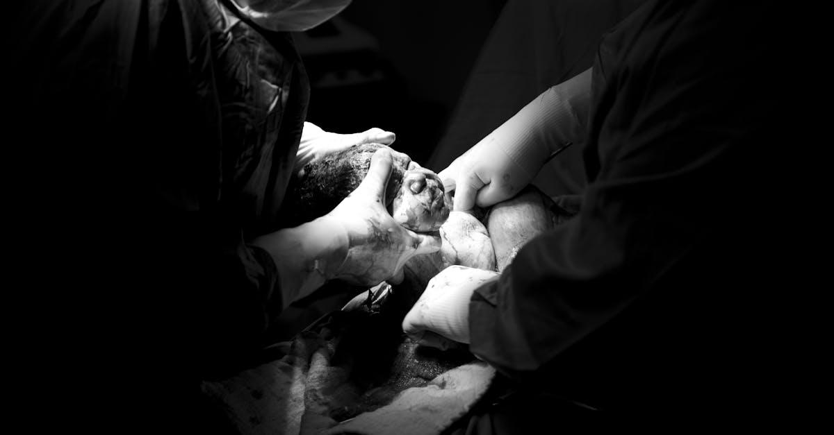 découvrez tout ce qu'il faut savoir sur la césarienne : procédures, avantages, inconvénients et conseils pour bien se préparer à cette intervention chirurgicale. informez-vous pour faire des choix éclairés concernant votre accouchement.