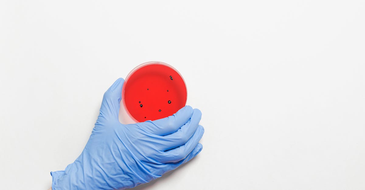 découvrez des stratégies efficaces pour la prévention des infections, incluant des conseils pratiques, des protocoles de désinfection et l'importance de l'hygiène personnelle pour protéger votre santé et celle des autres.