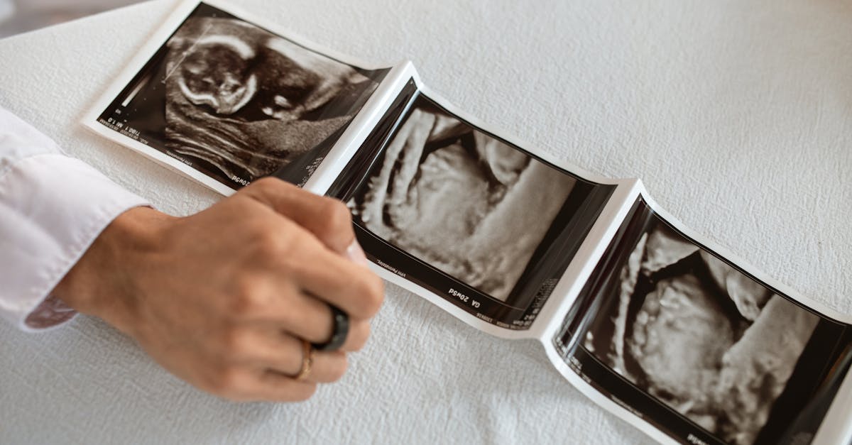 découvrez le miracle de la naissance, un événement unique et émouvant qui marque le début de la vie. explorez les différentes étapes de la grossesse, le rôle des parents, et les émotions entourant la venue au monde d'un nouvel être.