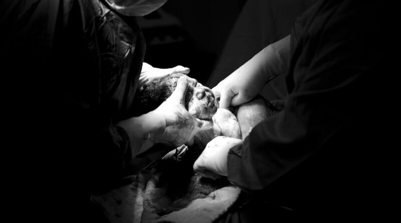 découvrez tout ce qu'il faut savoir sur la césarienne, une méthode d'accouchement de plus en plus pratiquée. informez-vous sur ses avantages, ses risques, et le processus étape par étape pour aborder cette intervention avec sérénité.