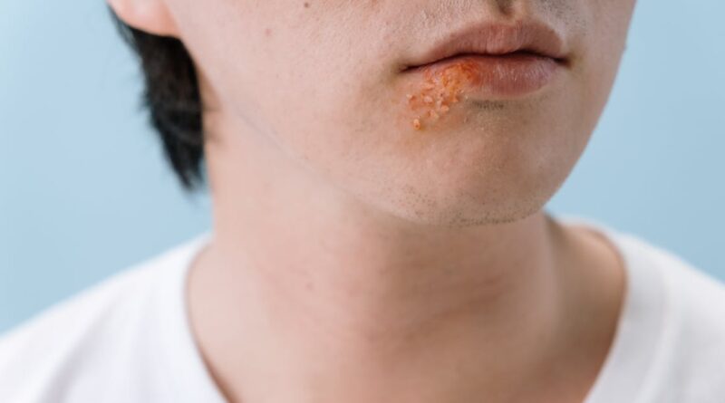découvrez les symptômes courants des infections, incluant la fièvre, la fatigue et les douleurs corporelles. apprenez à reconnaître les signes de maladies infectieuses pour agir rapidement et consulter un professionnel de santé.